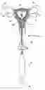 Fig. 01 - Uterine therapy device and method