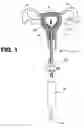 Fig. 02 - Uterine therapy device and method