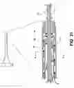 Fig. 10 - Uterine therapy device and method