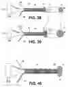 Fig. 12 - Uterine therapy device and method