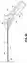 Fig. 20 - Uterine therapy device and method