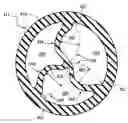 Fig. 01 - MULTI-LUMEN CATHETER INCLUDING A LUMEN HAVING A VARIABLE CROSS SECTIONAL AREA