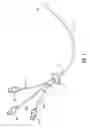 Fig. 02 - MULTI-LUMEN CATHETER INCLUDING A LUMEN HAVING A VARIABLE CROSS SECTIONAL AREA
