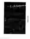 Fig. 03 - Guide-wire sleeve for facilitation of lesion crossing