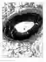 Fig. 20 - Guide-wire sleeve for facilitation of lesion crossing