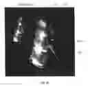 Fig. 12 - Systems and Methods for Thermally Profiling Radiofrequency Electrodes