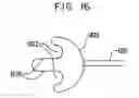 Fig. 09 - System and method for performing ablation using an expandable member