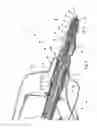 Fig. 03 - Device to open and close a bodily wall