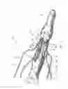 Fig. 05 - Device to open and close a bodily wall