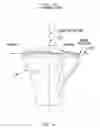 Fig. 06 - Method and apparatus for performing an open wedge, high tibial osteotomy