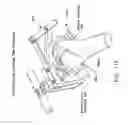 Fig. 16 - Method and apparatus for performing an open wedge, high tibial osteotomy