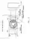 Fig. 20 - Method and apparatus for performing an open wedge, high tibial osteotomy