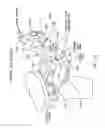 Fig. 30 - Method and apparatus for performing an open wedge, high tibial osteotomy