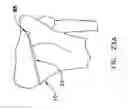 Fig. 32 - Method and apparatus for performing an open wedge, high tibial osteotomy