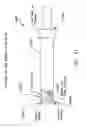 Fig. 50 - Method and apparatus for performing an open wedge, high tibial osteotomy