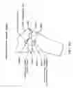 Fig. 59 - Method and apparatus for performing an open wedge, high tibial osteotomy