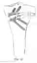 Fig. 70 - Method and apparatus for performing an open wedge, high tibial osteotomy