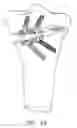 Fig. 71 - Method and apparatus for performing an open wedge, high tibial osteotomy