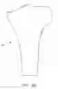 Fig. 74 - Method and apparatus for performing an open wedge, high tibial osteotomy