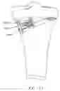 Fig. 80 - Method and apparatus for performing an open wedge, high tibial osteotomy