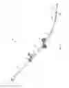 Fig. 03 - Systems and methods for internal bone fixation