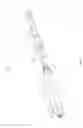 Fig. 05 - Systems and methods for internal bone fixation