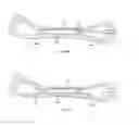 Fig. 16 - Systems and methods for internal bone fixation