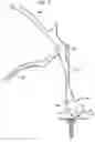 Fig. 08 - Tether tensioning instrument