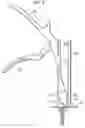 Fig. 09 - Tether tensioning instrument
