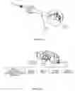 Fig. 05 - Bone fixation implant system and method
