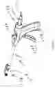 Fig. 17 - Bone fixation implant system and method