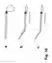 Fig. 11 - Methods and devices for eye surgery