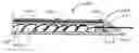 Fig. 01 - Embolization coil delivery systems and methods