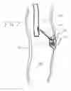 Fig. 07 - Embolization coil delivery systems and methods