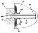 Fig. 01 - Surgical threading device and method for using same