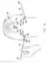 Fig. 09 - Surgical threading device and method for using same