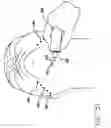 Fig. 28 - Surgical threading device and method for using same