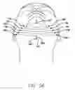 Fig. 33 - Surgical threading device and method for using same