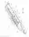 Fig. 60 - Systems and Methods for Treating Septal Defects