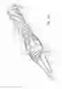Fig. 68 - Systems and Methods for Treating Septal Defects