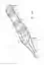 Fig. 69 - Systems and Methods for Treating Septal Defects