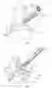 Fig. 03 - Blind rivet for adapting biological tissue and device for setting the same, in particular through the instrument channel of an endoscope