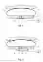 Fig. 02 - Controllable stomach band