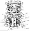 Fig. 01 - Anterior cervical staple