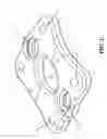 Fig. 03 - Anterior cervical staple