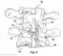 Fig. 07 - Spline Implant