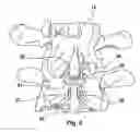 Fig. 09 - Spline Implant