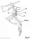 Fig. 10 - Spline Implant