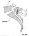 Fig. 11 - Spline Implant