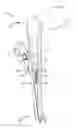 Fig. 01 - Instruments and methods for tensioning a spinal tether